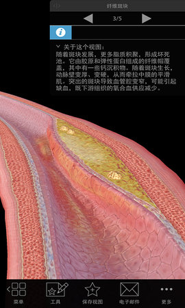 3D生理和病理学 2 旧版 1