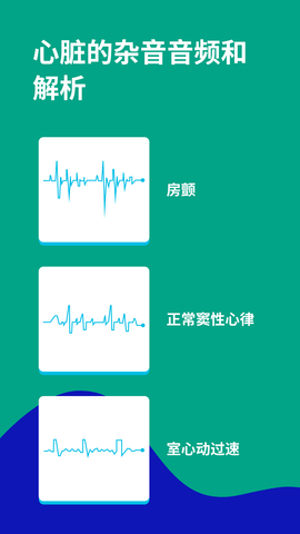 心电图ECG 1.7  3