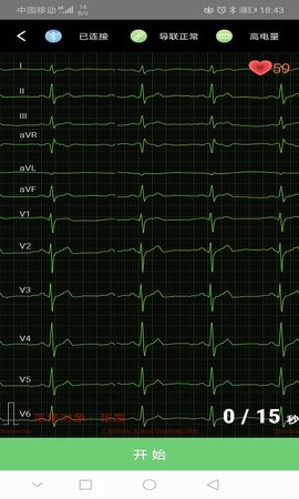 康乃心测心电 2.0.10 最新版 3